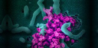 南加州大学研究重点转为应对新型冠状病毒危机