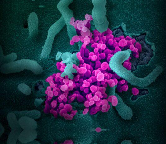 南加州大学研究重点转为应对新型冠状病毒危机
