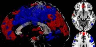 英国伯恩茅斯大学完成首例核磁共振_MRI脑部科研扫描