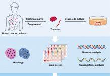 澳门大学提出精准治疗乳癌新策略