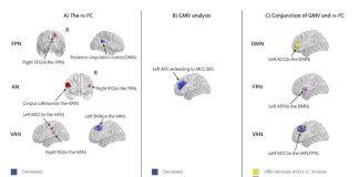 澳门大学在行为成瘾与神经决策研究取得重要进展