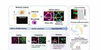 澳门大学开发创新检测技术筛查早期糖尿病