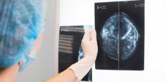 研究揭示人工智能帮助检测乳腺癌