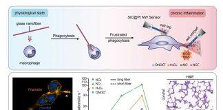 黄卫华课题组在纳米电化学定量监测沮丧吞噬ROS/RNS泄露方面获得新进展